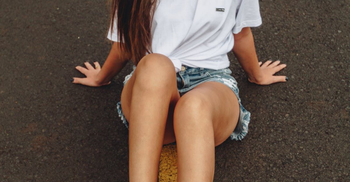 Genetic factors impacting hair