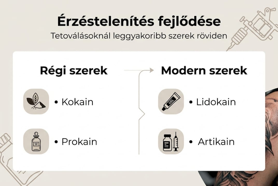 Infografika: Milyen érzéstelenítési lehetőségek léteznek tetoválásnál?