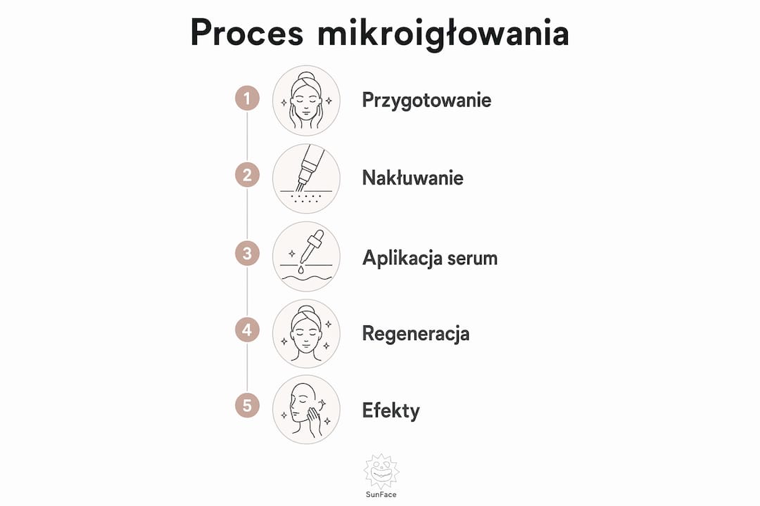 Przegląd zabiegu mikroigłowania – etapy oraz rezultaty na infografice