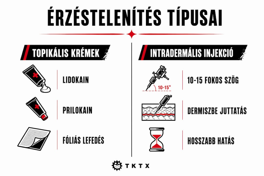 Infografika: melyik érzéstelenítési eljárás mit tud? Összehasonlító áttekintés