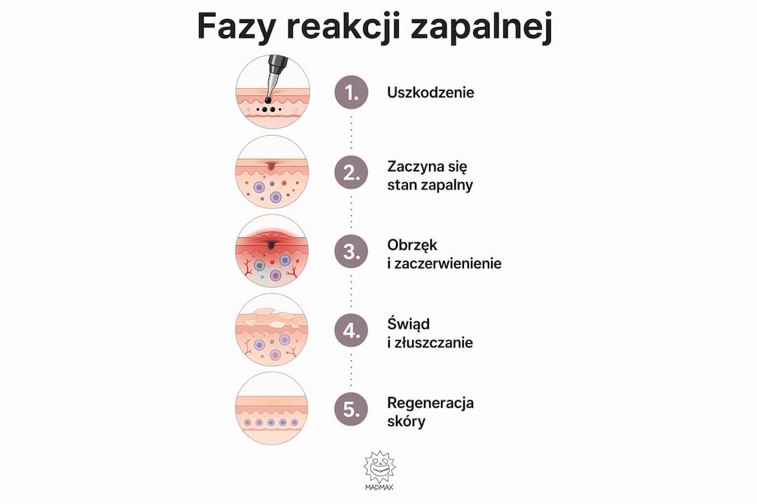 Grafika przedstawiająca kolejne fazy zapalenia skóry po wykonaniu tatuażu