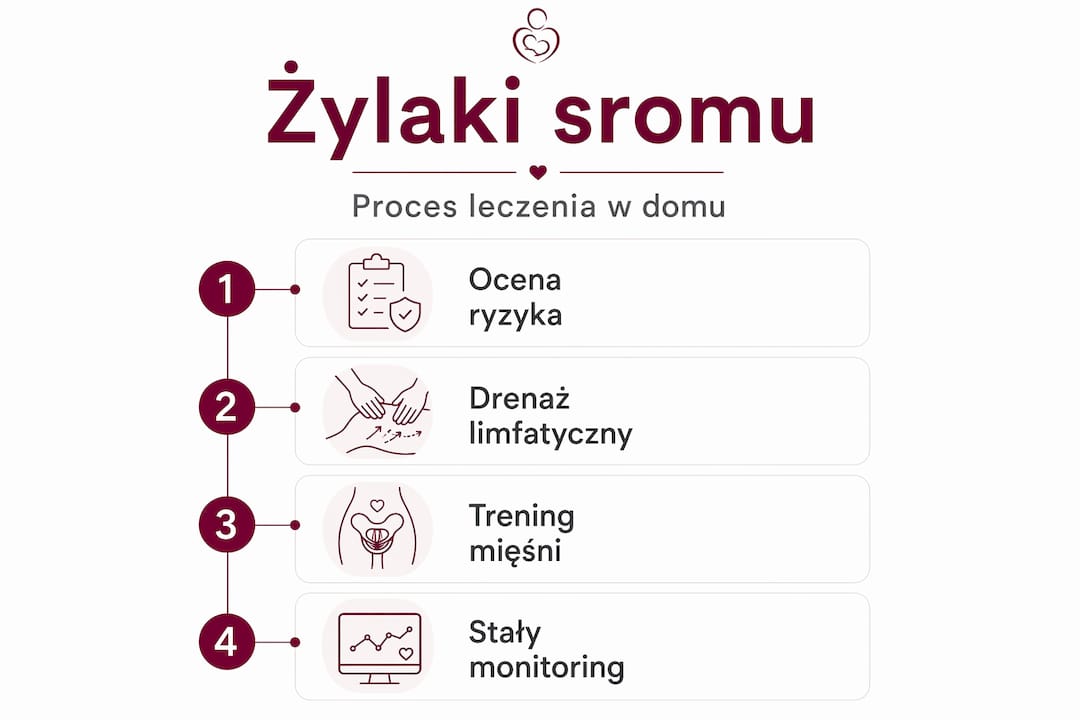 Infografika przedstawiająca krok po kroku proces domowego leczenia