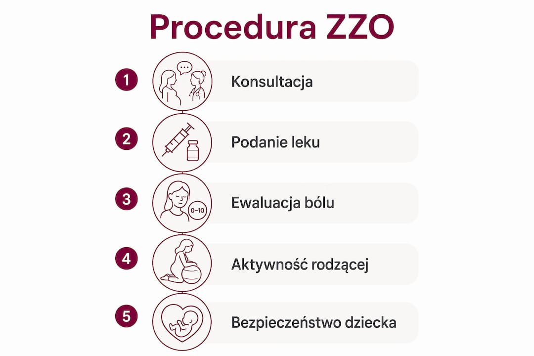 Infografika pokazująca kolejne kroki podczas znieczulenia zewnątrzoponowego