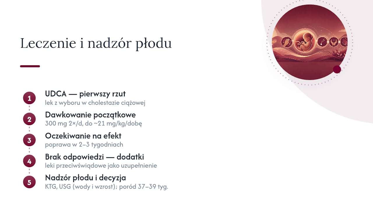 Leczenie i nadzór płodu: UDCA, alternatywy i praktyczne wskazówki — overview diagram