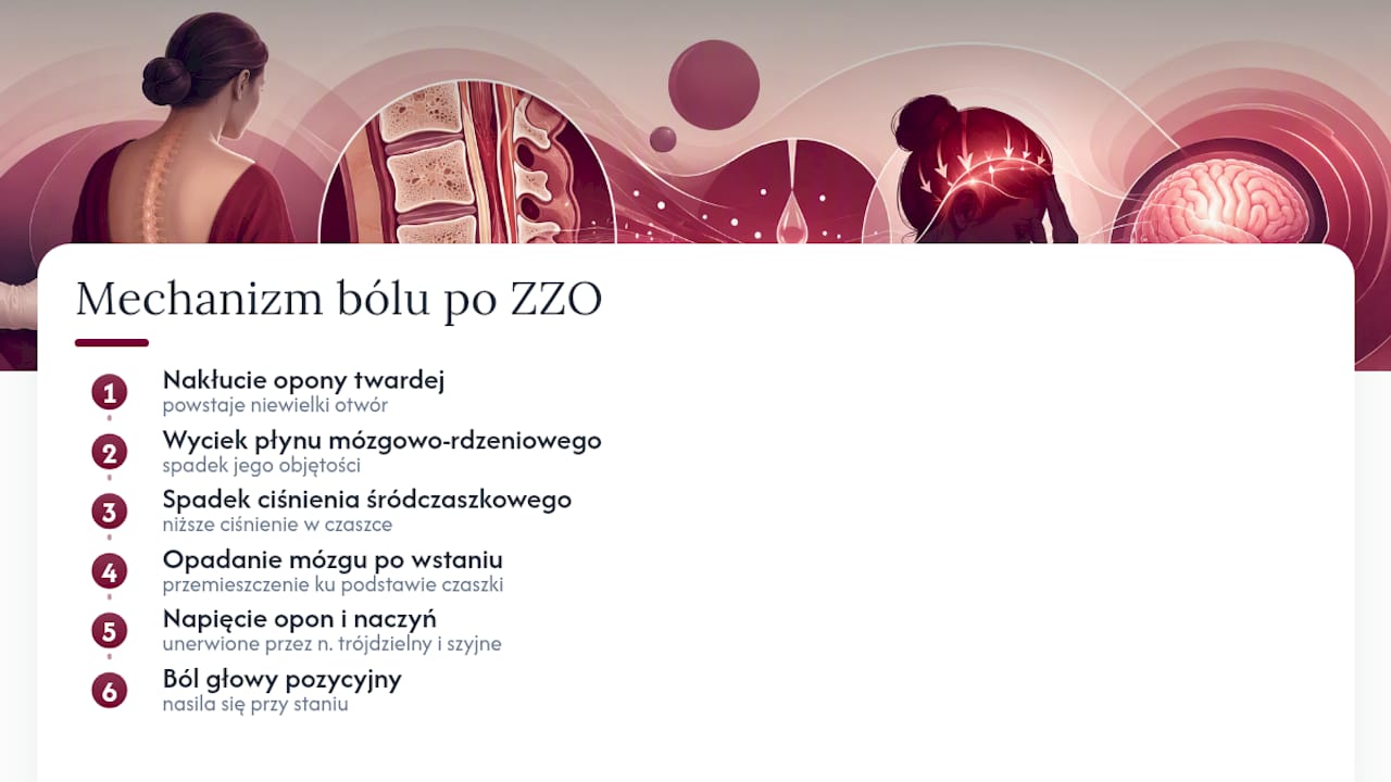 Mechanizm powstawania bólu po znieczuleniu ogólnym