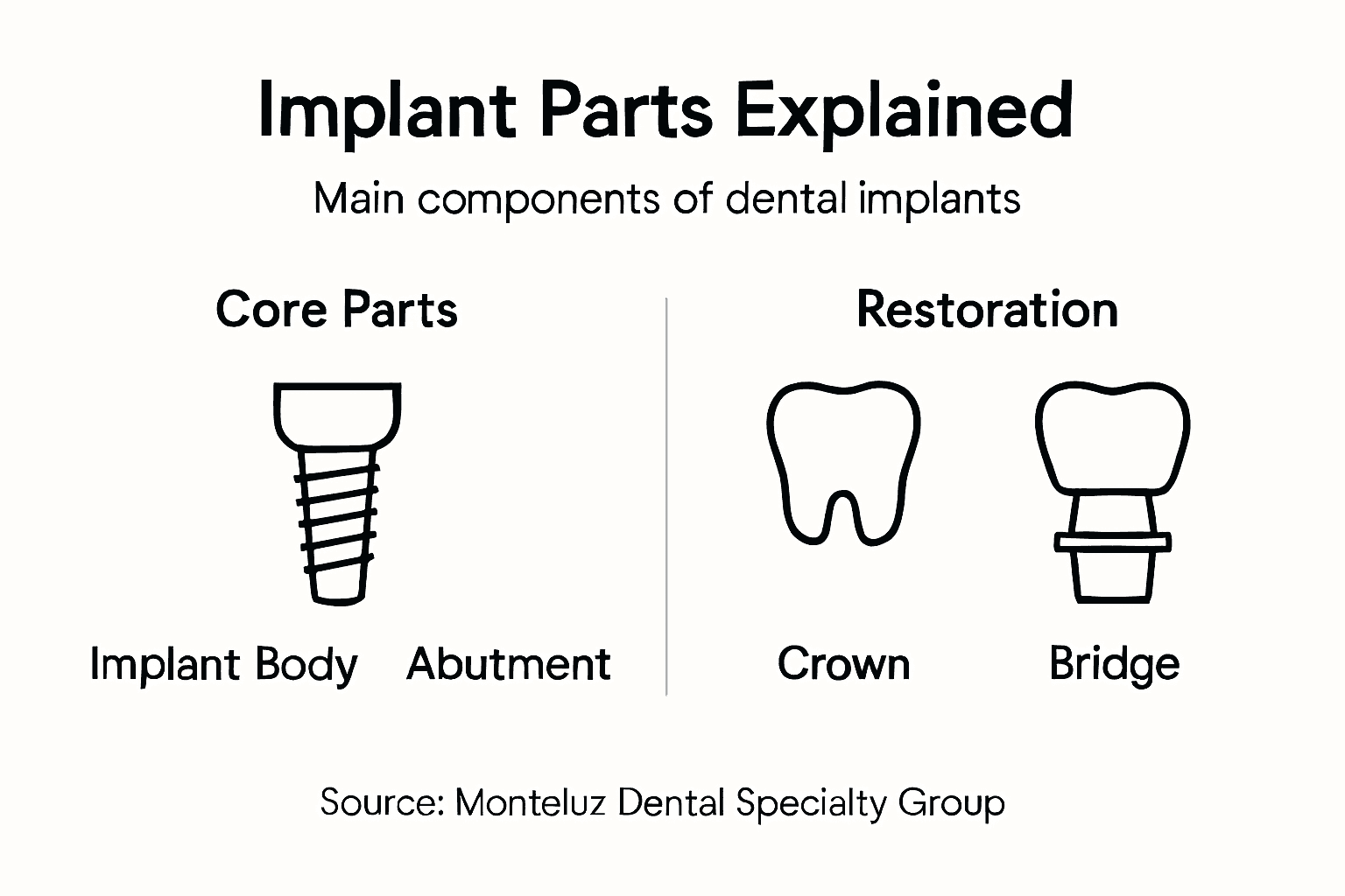 Infographic showing main implant components and terms