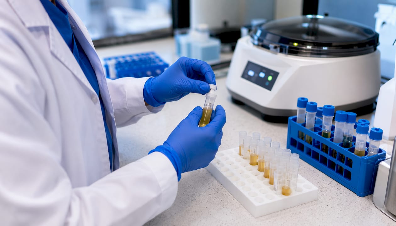 Lab technician handling drug test urine samples