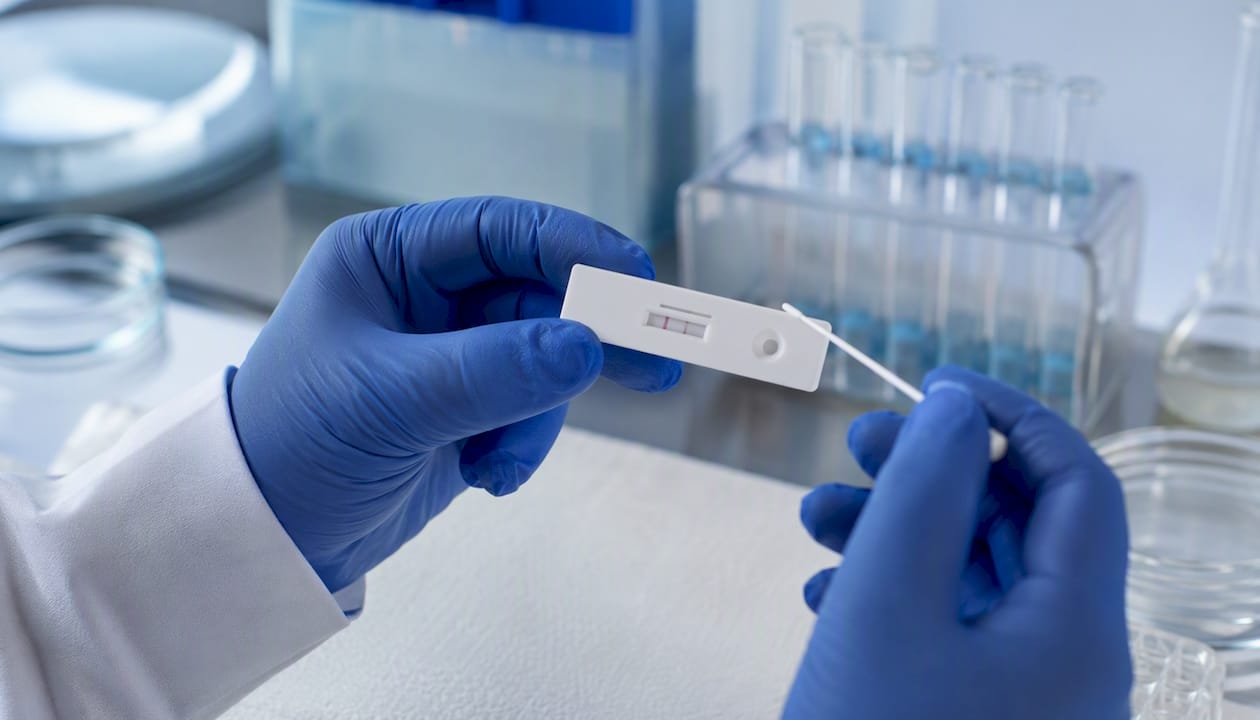 Gloved hands inspecting urine drug test strip