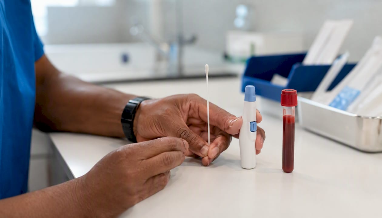Specimens for HIV testing on clinical counter