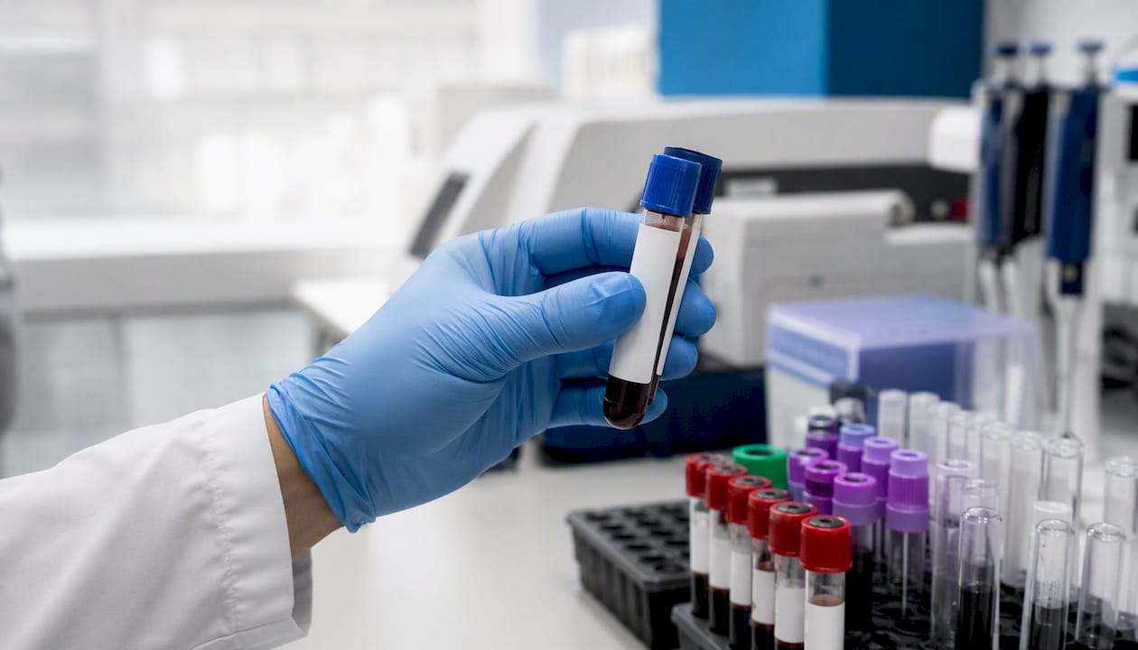 Gloved hand holding blood sample vial