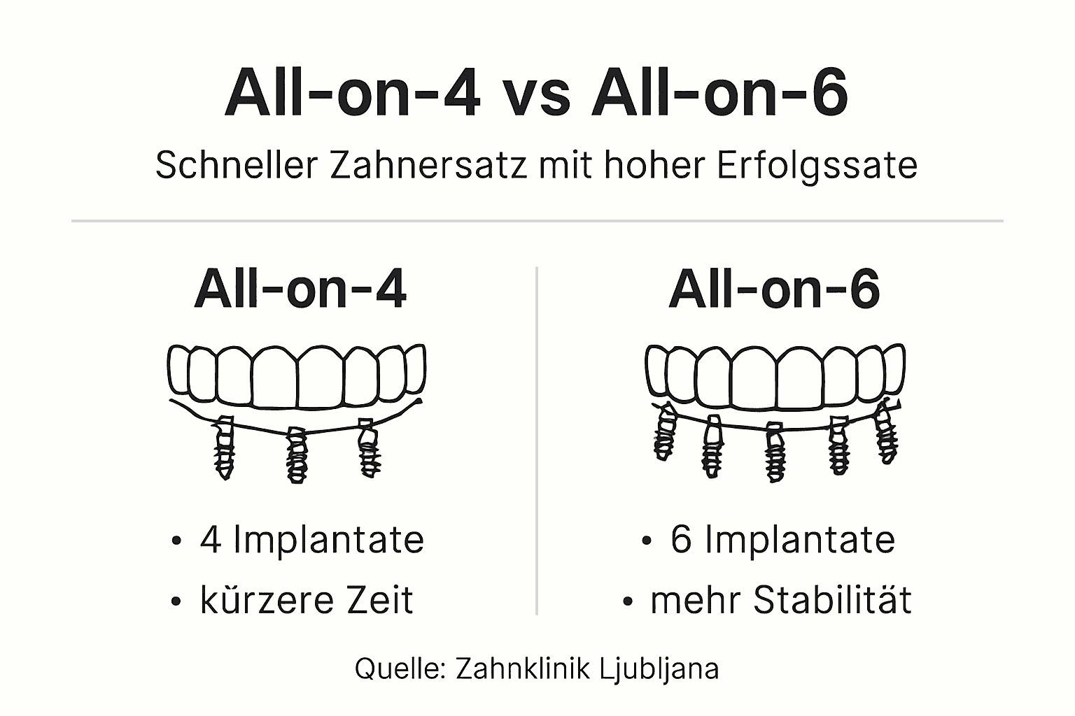 Vergleichsgrafik: All-on-4 vs. All-on-6 – die wichtigsten Unterschiede auf einen Blick