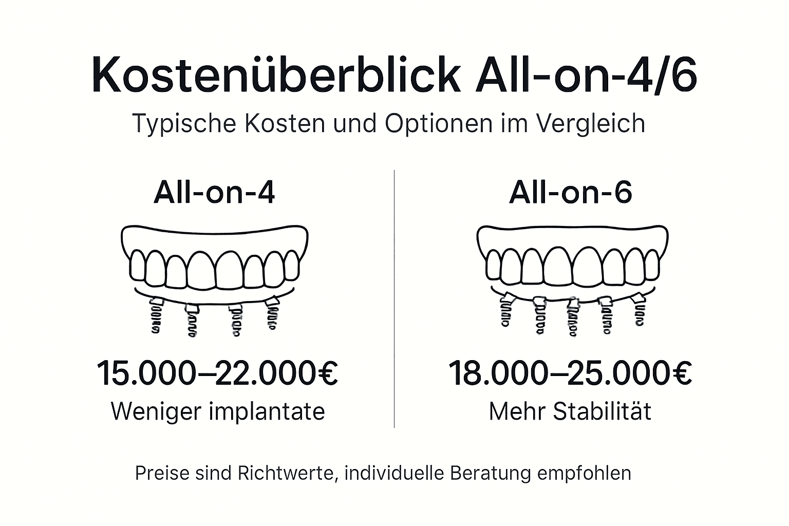 Eine anschauliche Grafik zeigt die Kostenunterschiede zwischen All-on-4 und All-on-6 Implantaten auf einen Blick.