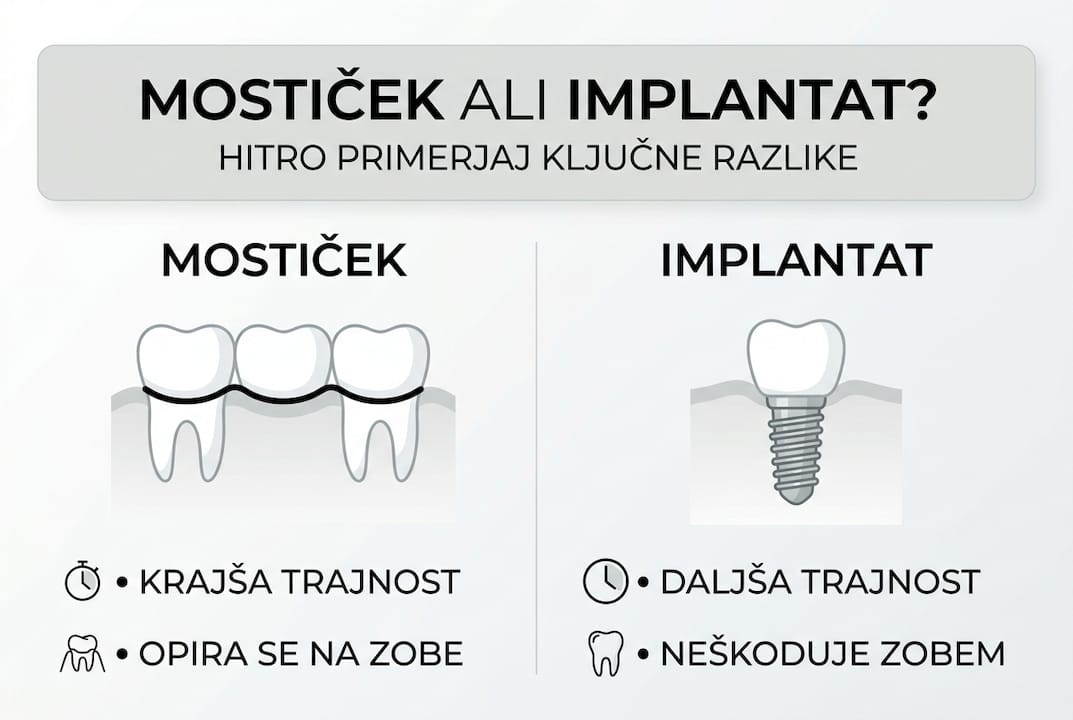Pregledna grafika, ki prikazuje glavne razlike med zobnim mostičkom in implantatom