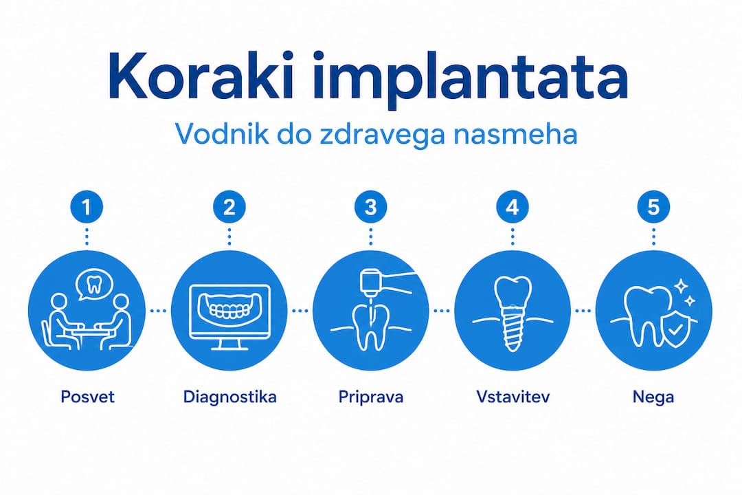 Na infografiki so prikazani ključni koraki, ki jih je dobro upoštevati pri izbiri implantata.