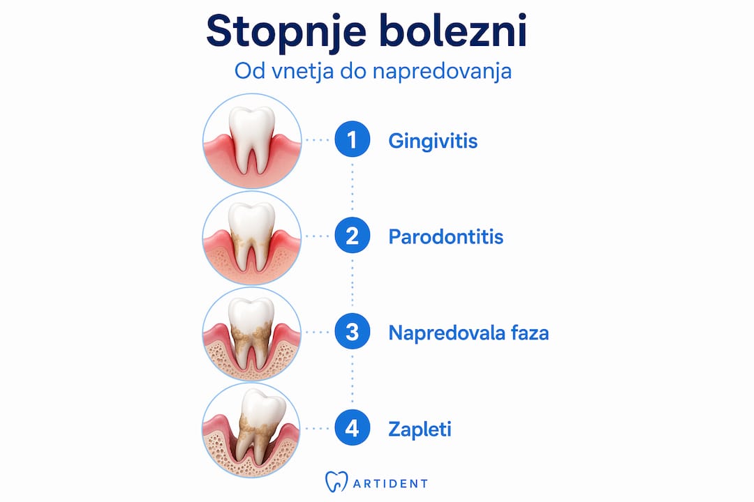 Pregleden grafični prikaz poteka bolezni po posameznih stopnjah, urejen navpično.