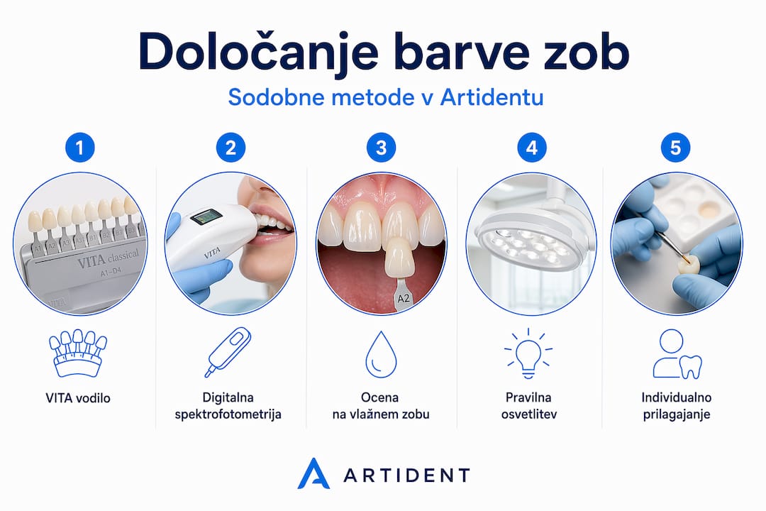 Pregled sodobnih načinov za ugotavljanje odtenka zob
