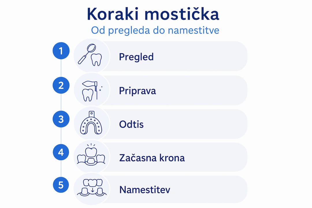 Na infografiki so prikazani ključni koraki pri načrtovanju mostička.