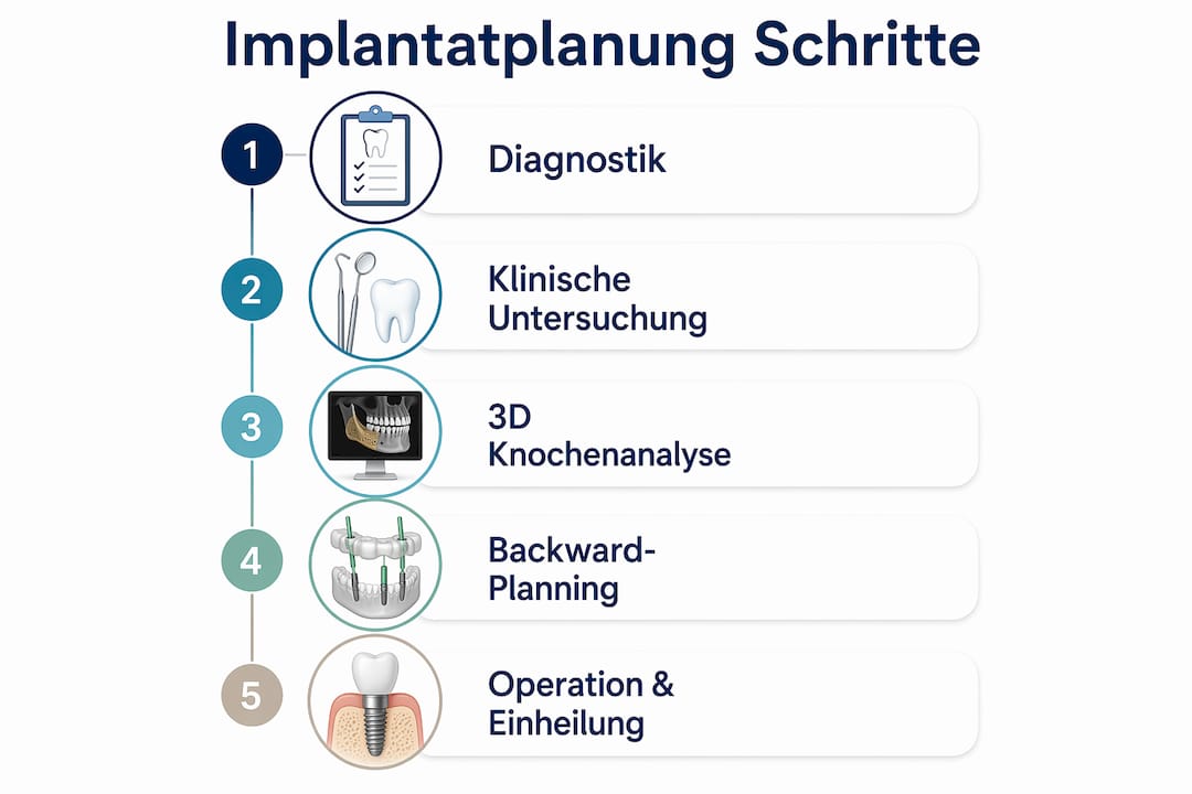 Grafische Übersicht: Die einzelnen Schritte bei der Planung von Zahnimplantaten
