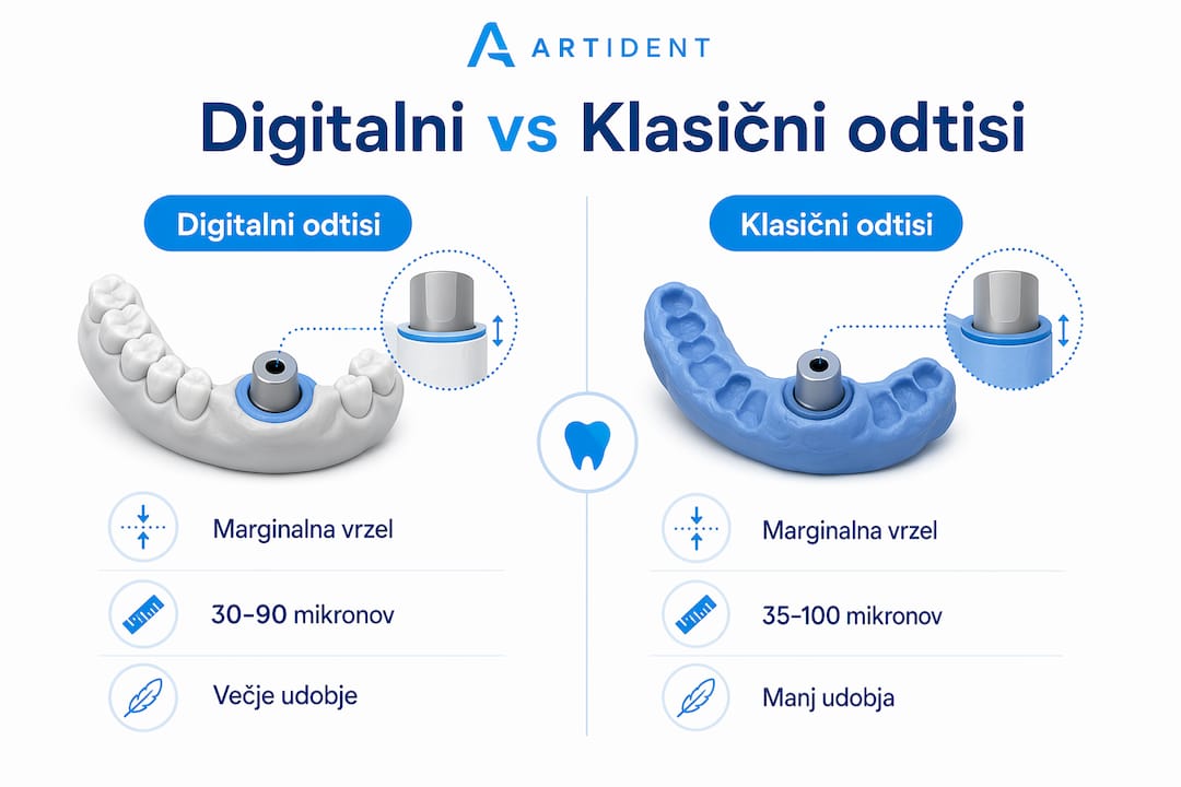 Digitalni odtis zob ali klasičen odtis – katera rešitev je boljša?