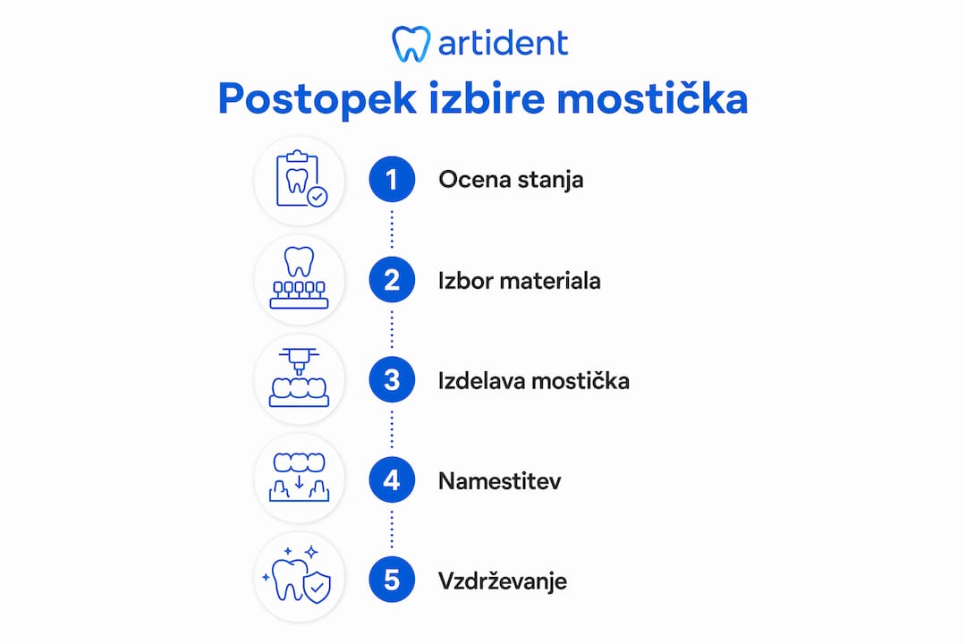Pregled najpomembnejših korakov pri izbiri zobnega mostička v obliki infografike