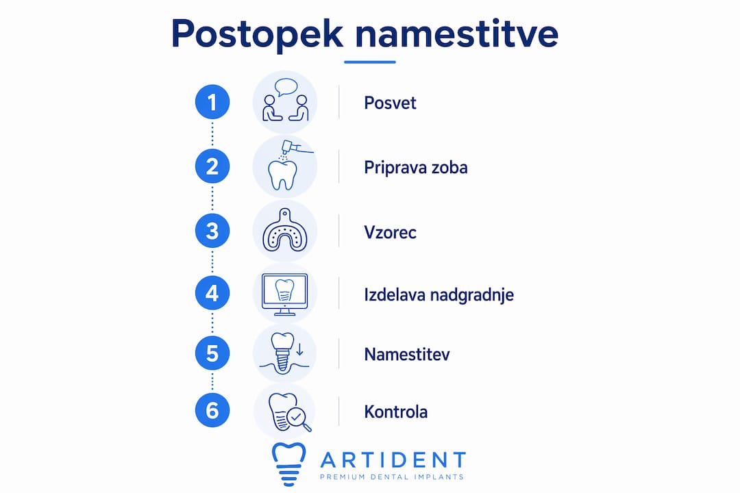 Infografika s prikazom postopnih korakov vgradnje zobne protetike