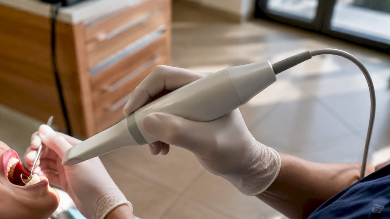 Detailaufnahme: Hände führen einen Intraoralscanner am Zahn aus