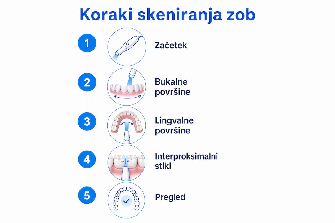 Infografika: kako pravilno poskenirati zobe – korak za korakom