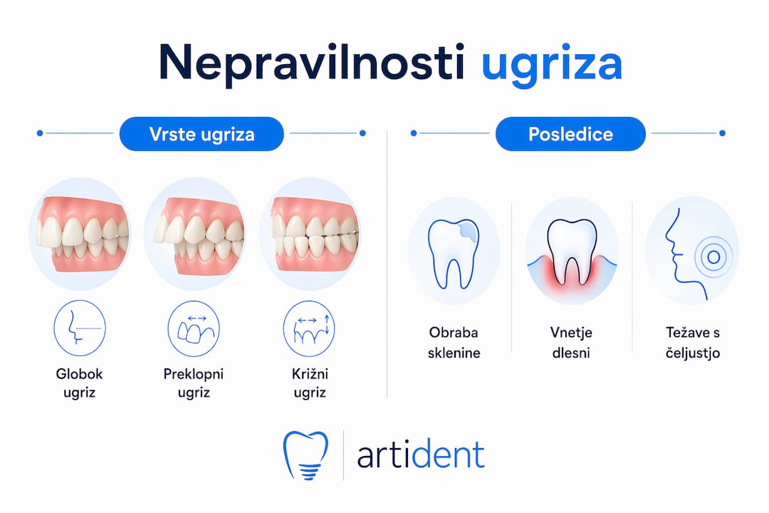Infografika: kako nepravilnosti ugriza vplivajo na zdravje naših zob