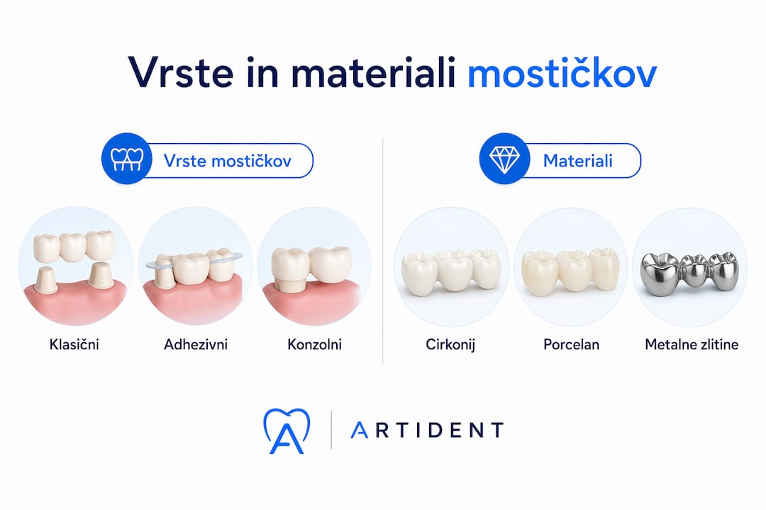 Pregled vrst zobnih mostičkov in materialov, iz katerih so izdelani – vse na enem mestu v infografiki.
