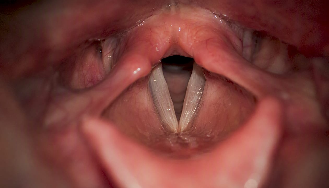 Vue en gros plan des cordes vocales mettant en évidence les différences de tension.
