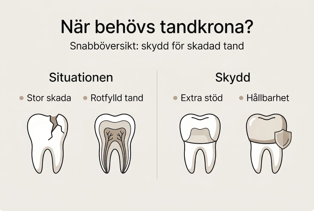 Illustration: När är det dags för en tandkrona?