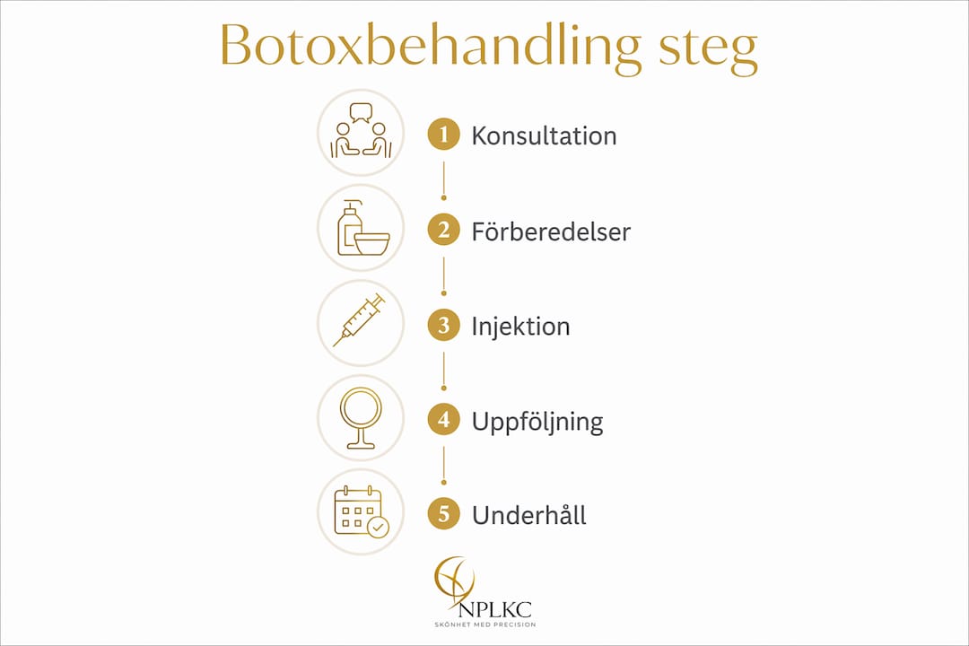 Illustration som visar hur en behandling med Botox går till, steg för steg
