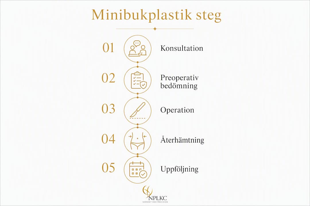 Illustration som steg för steg visar hur en minibukplastik går till