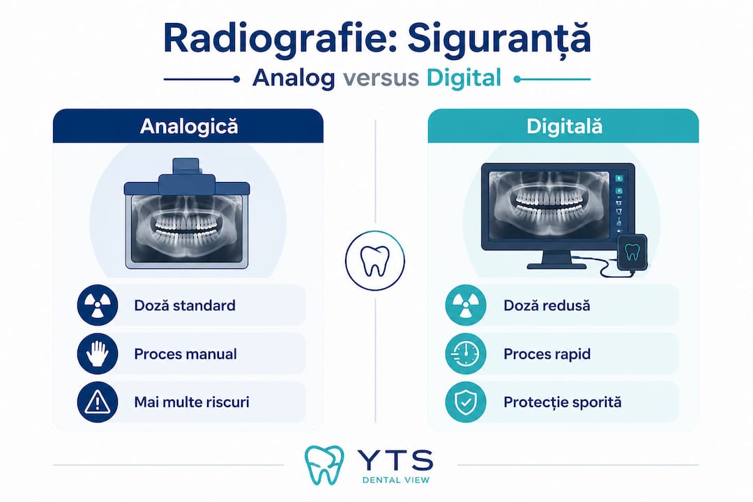 Infografic: diferențele dintre radiografia clasică și cea digitală
