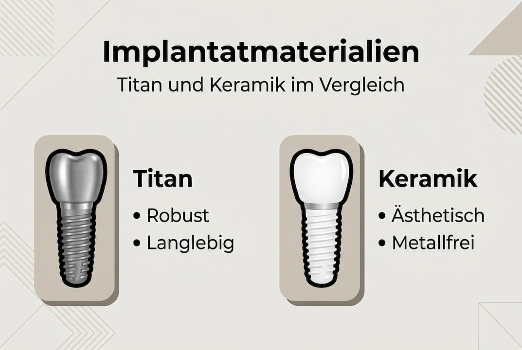 Infografik: Titan- vs. Keramik-Zahnimplantate im Vergleich