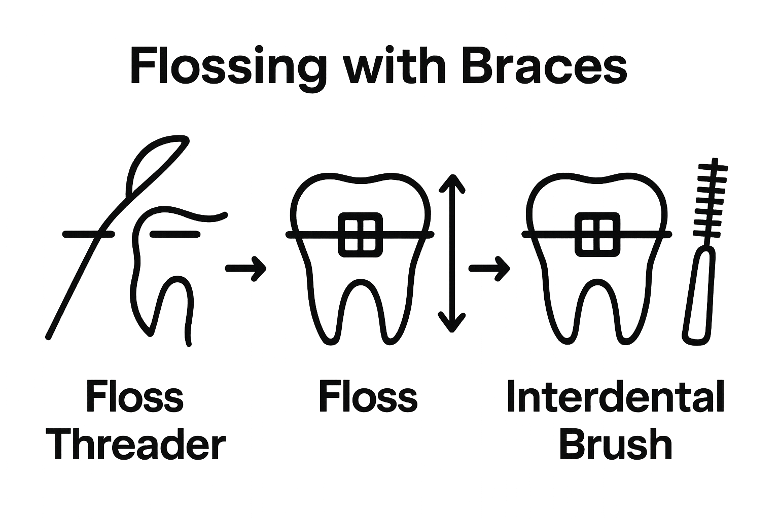 Infographic showing how to floss with braces in three clear steps