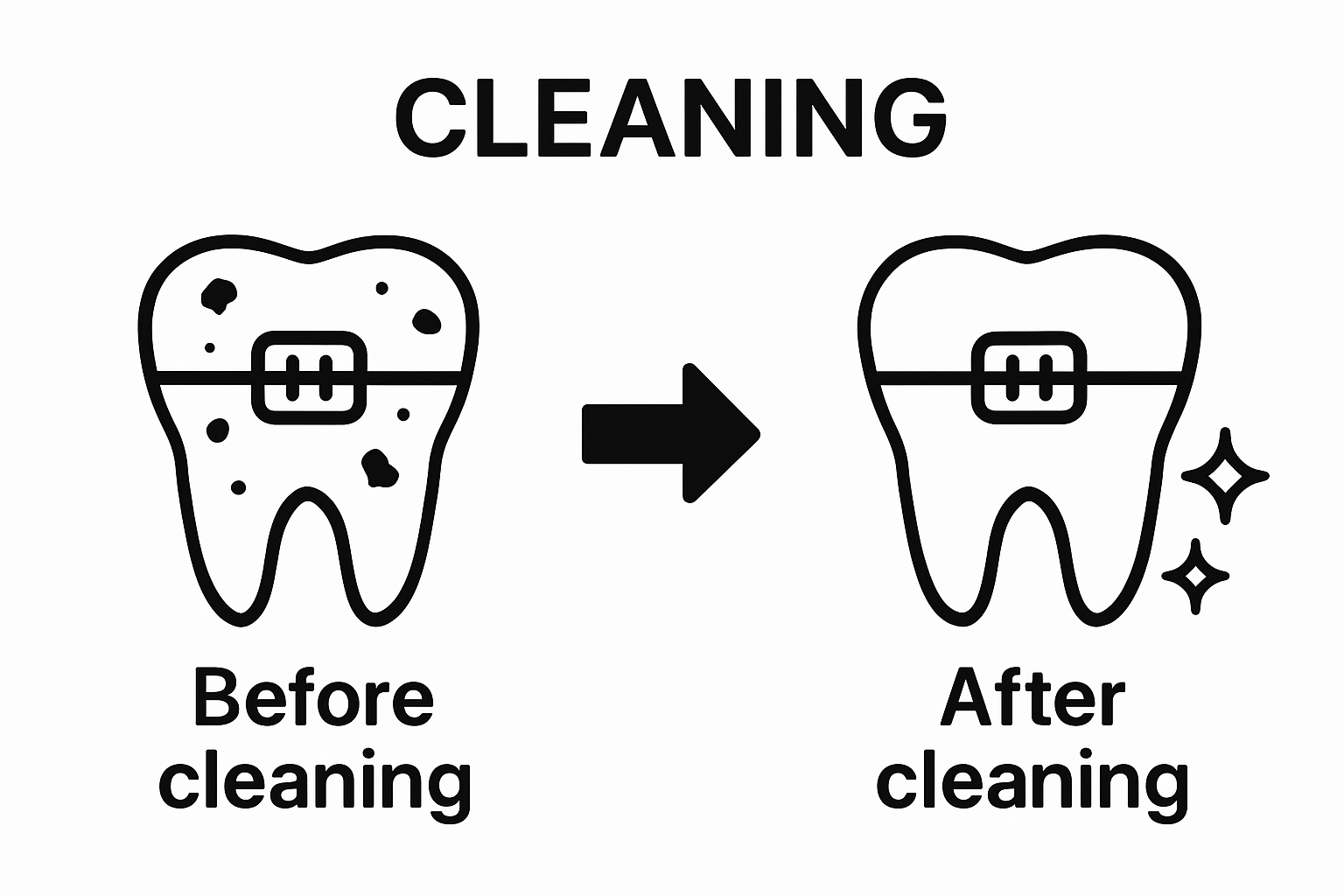 Comparison of teeth with braces before and after cleaning
