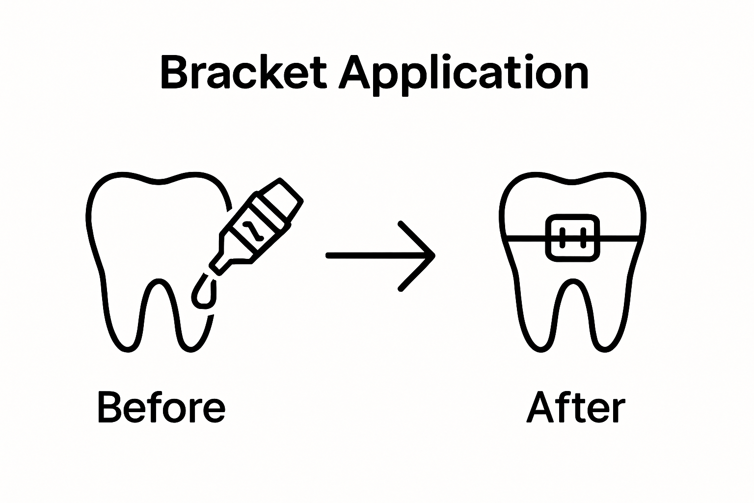 Visual sequence showing tooth before and after bracket placement