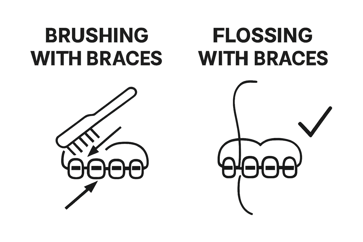 Simple infographic of brushing and flossing with braces