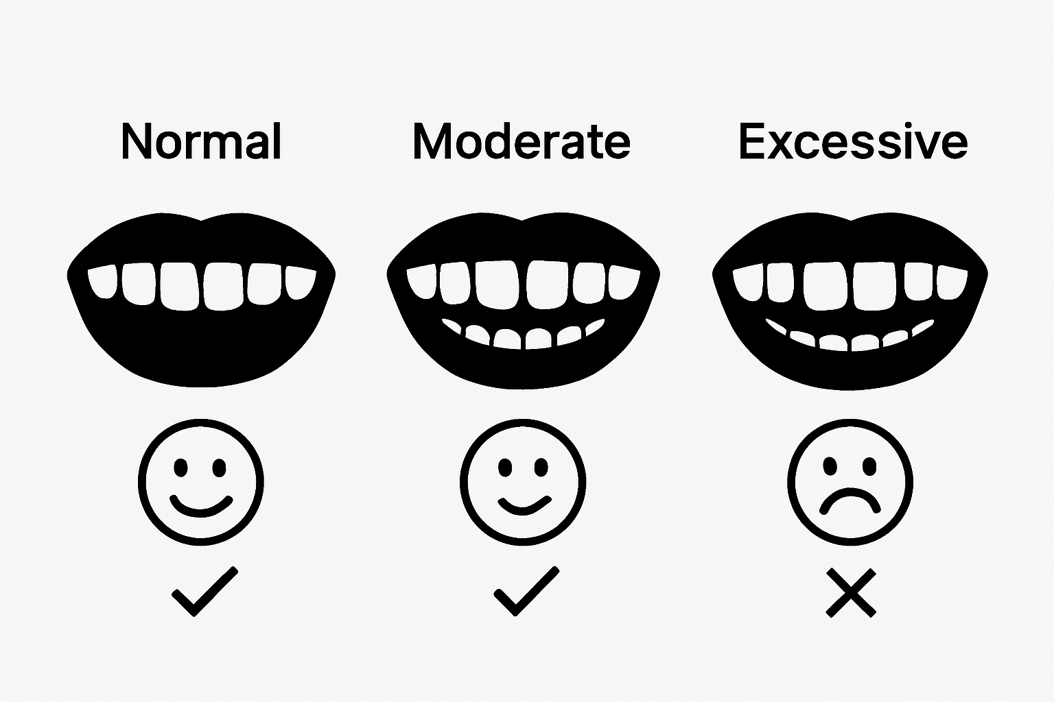 Comparison of normal, moderate, and excessive teeth spacing