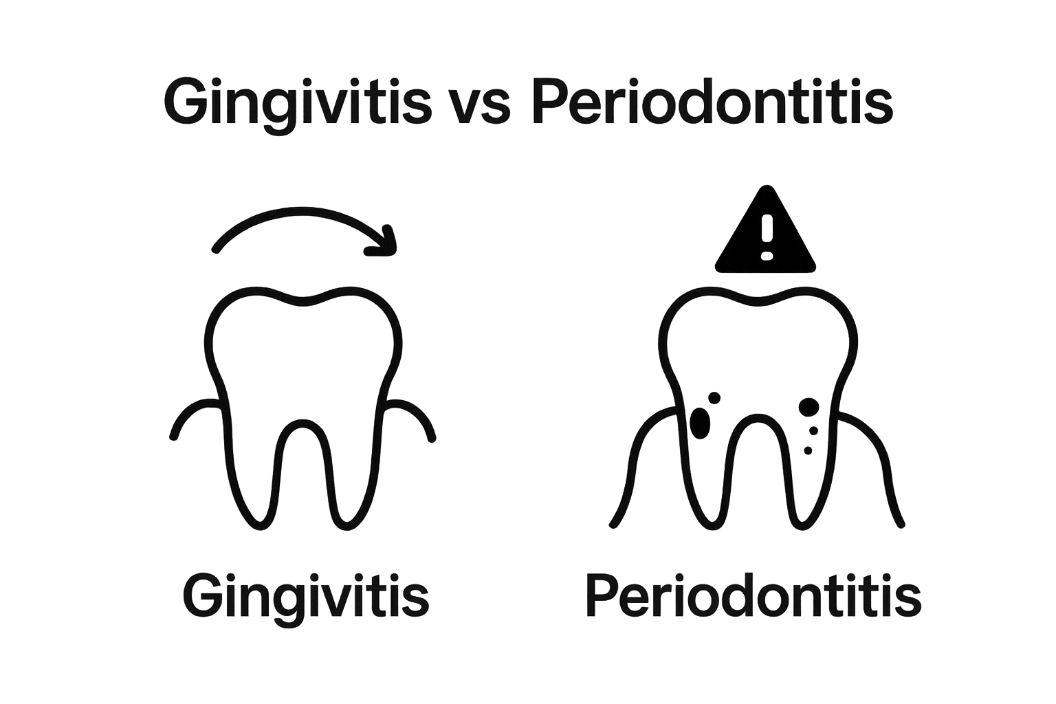 Gingivitis and periodontitis gum disease comparison graphic
