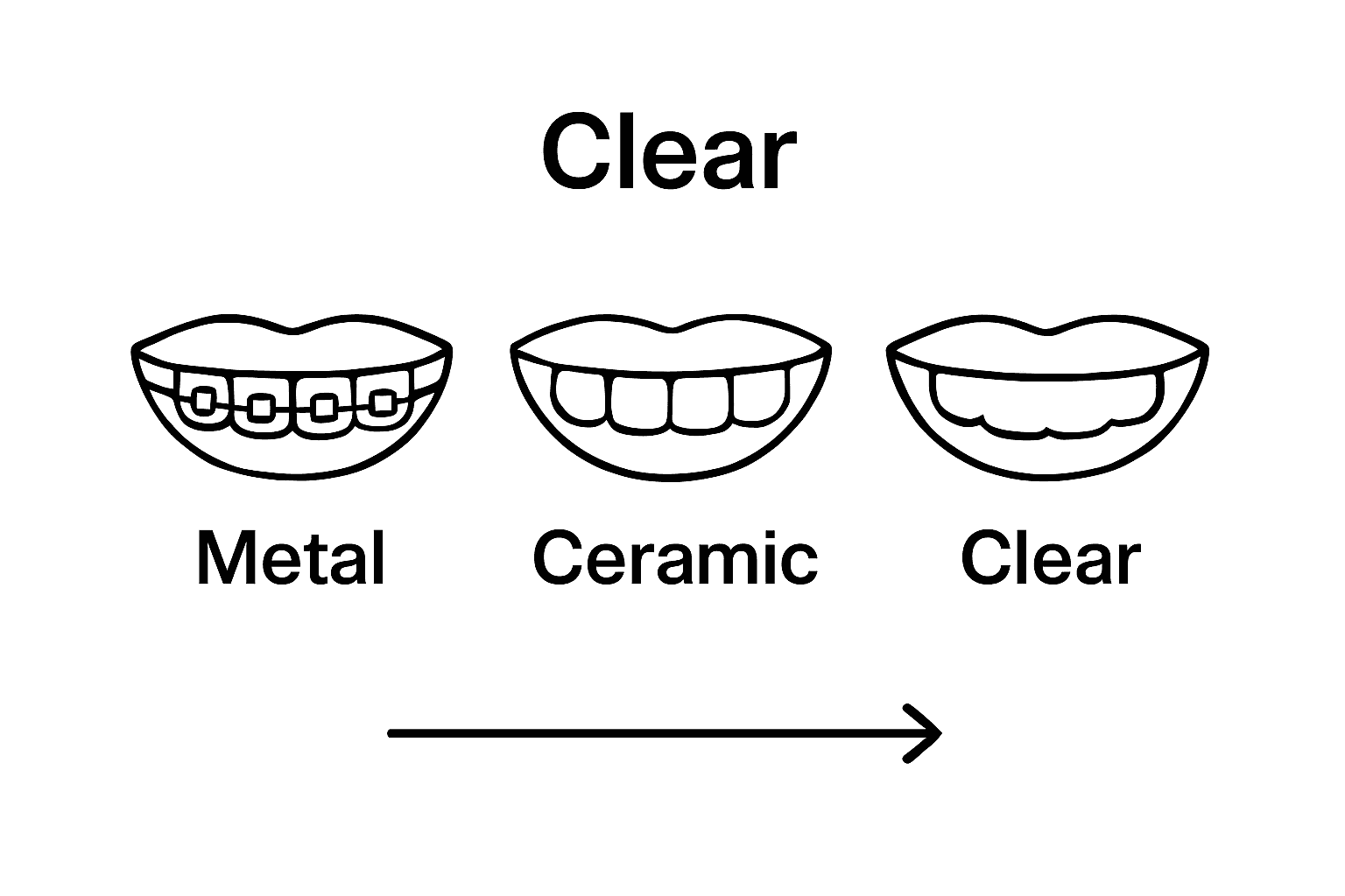 Comparison of metal braces, ceramic braces, and clear aligners