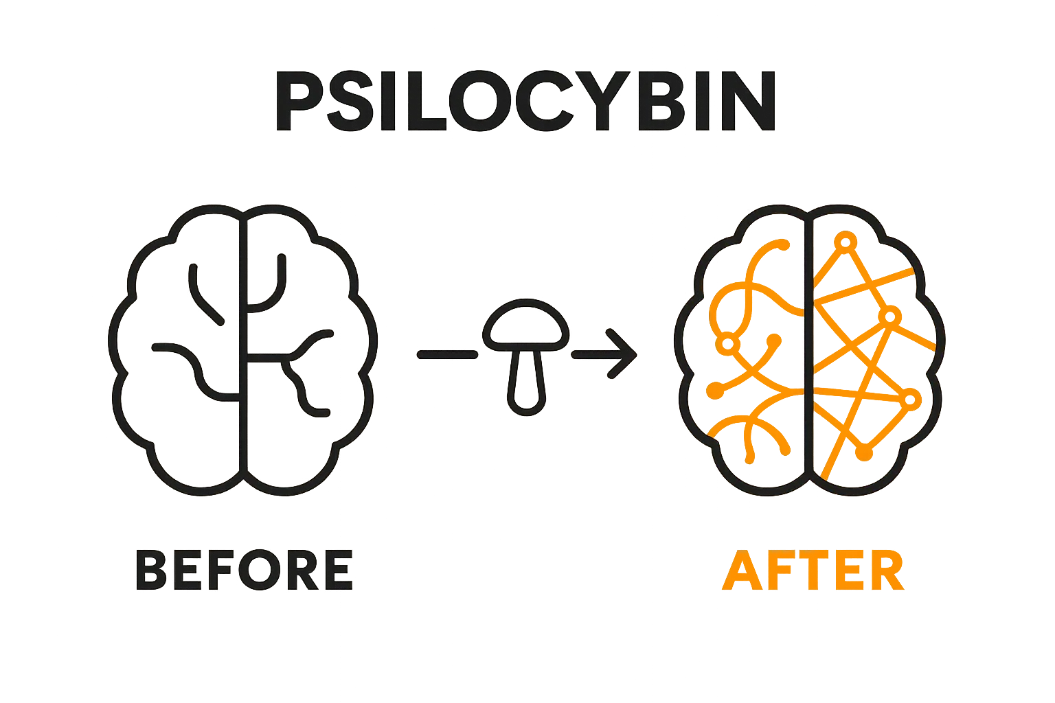 Brain before and after psilocybin neuroplasticity infographic