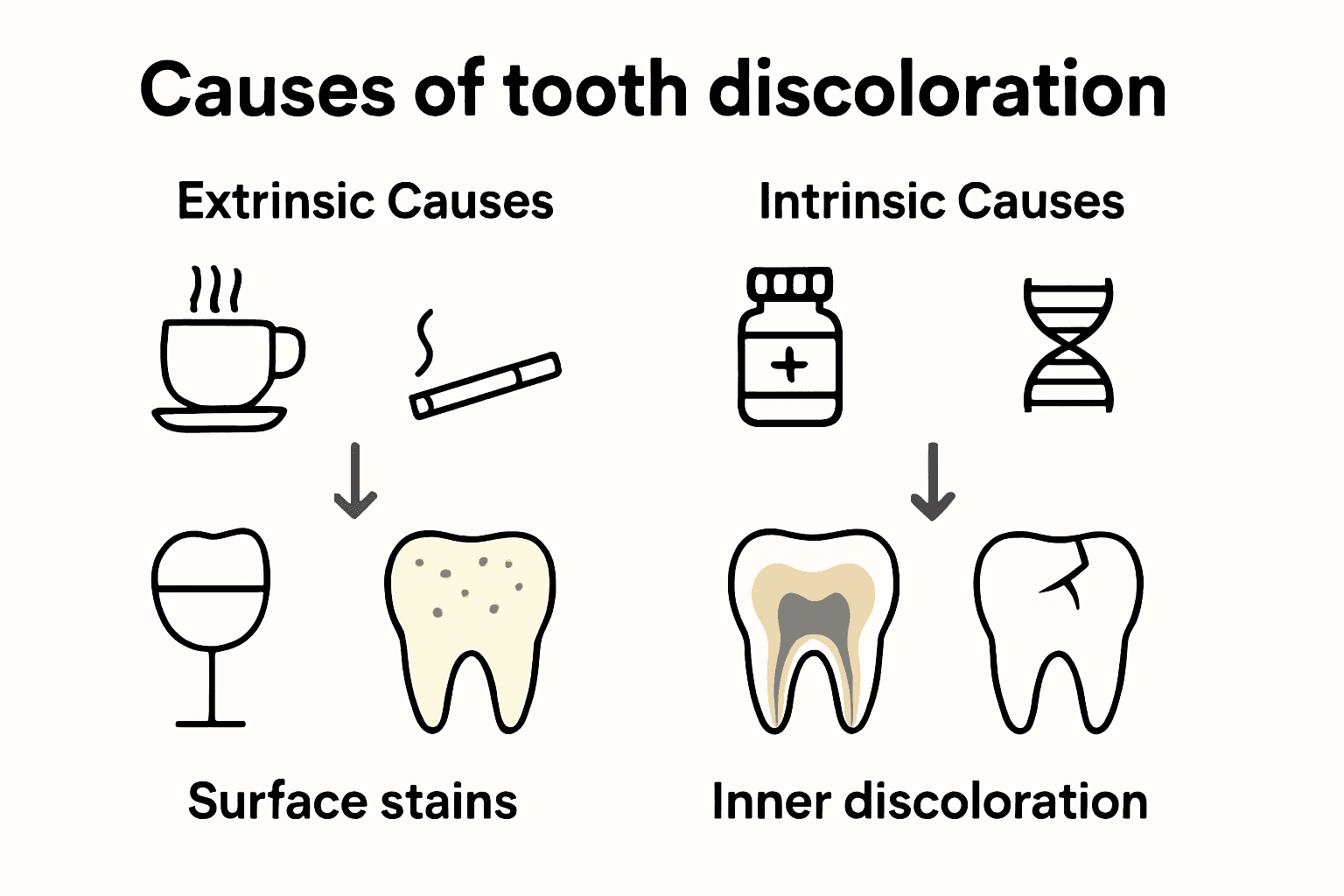 Infographic comparing extrinsic and intrinsic tooth discoloration causes with icons and arrows.