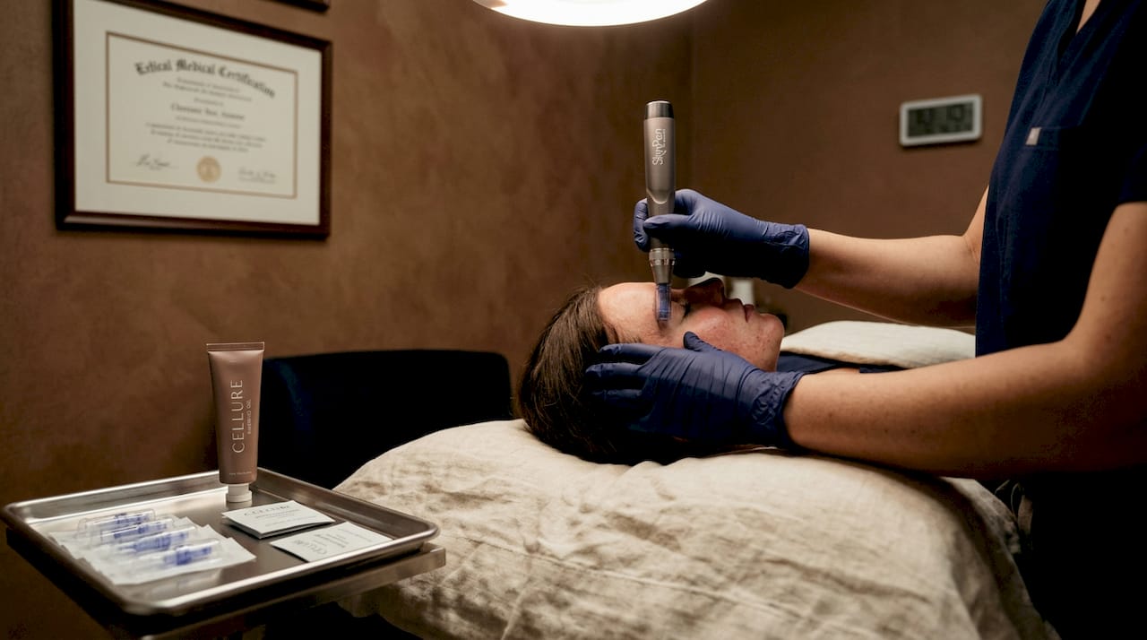 Dermatologist administering microneedling on patient's cheek