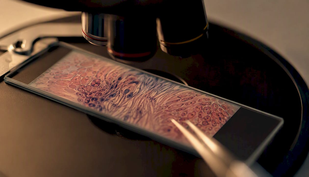 Close-up of fibroblast and keratinocyte skin cells