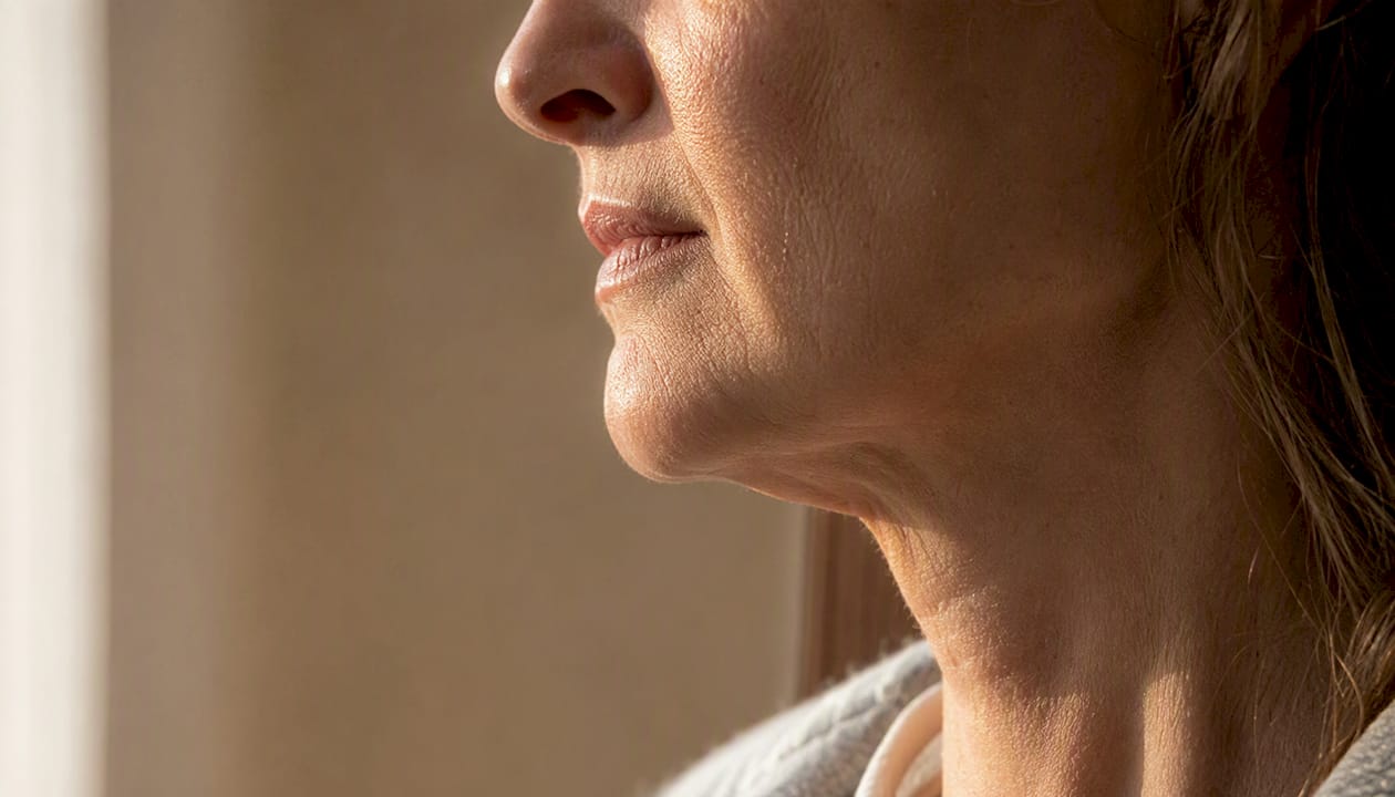 Side profile showing facial volume and contours