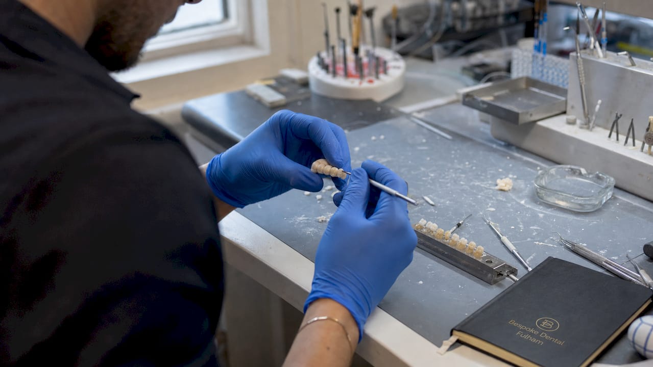 Hands shaping composite material for dental restoration