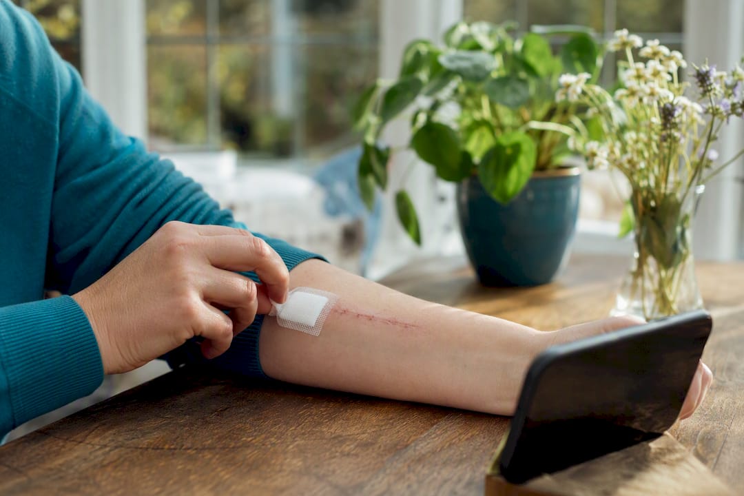 Hands photographing healing scar on arm