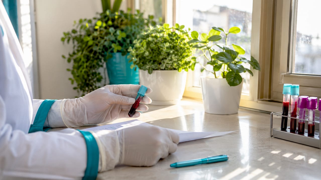O mână ține o eprubetă cu probă de sânge într-un laborator medical.